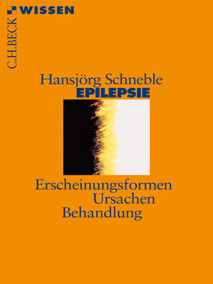cover image of Epilepsie